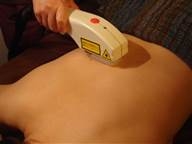 光脱毛（ジェル不要スピーディー、ビタミンC美白ジェルケア付）